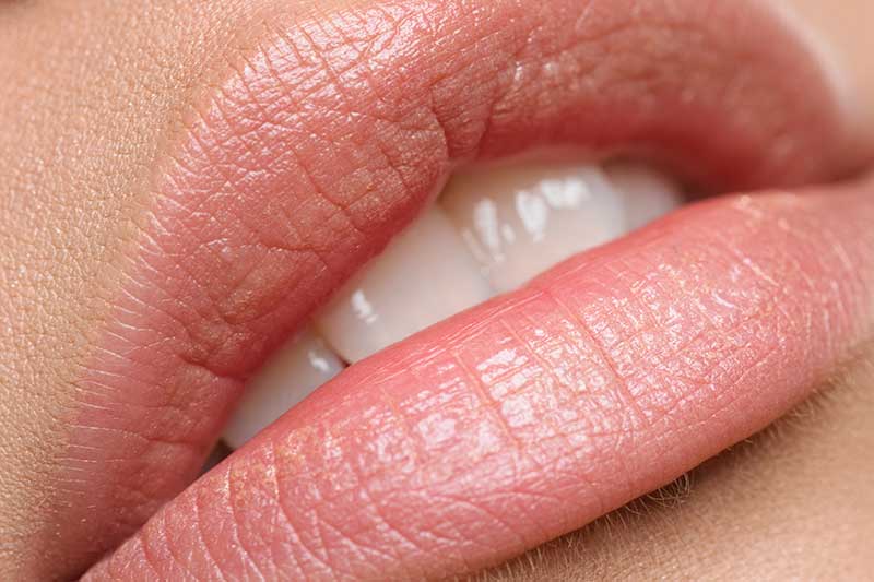 Bellezza, le 5 cose che non sapete per avere labbra più carnose