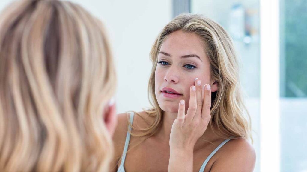 Trattare e prevenire l’acne, anche quando non si è più giovanissime